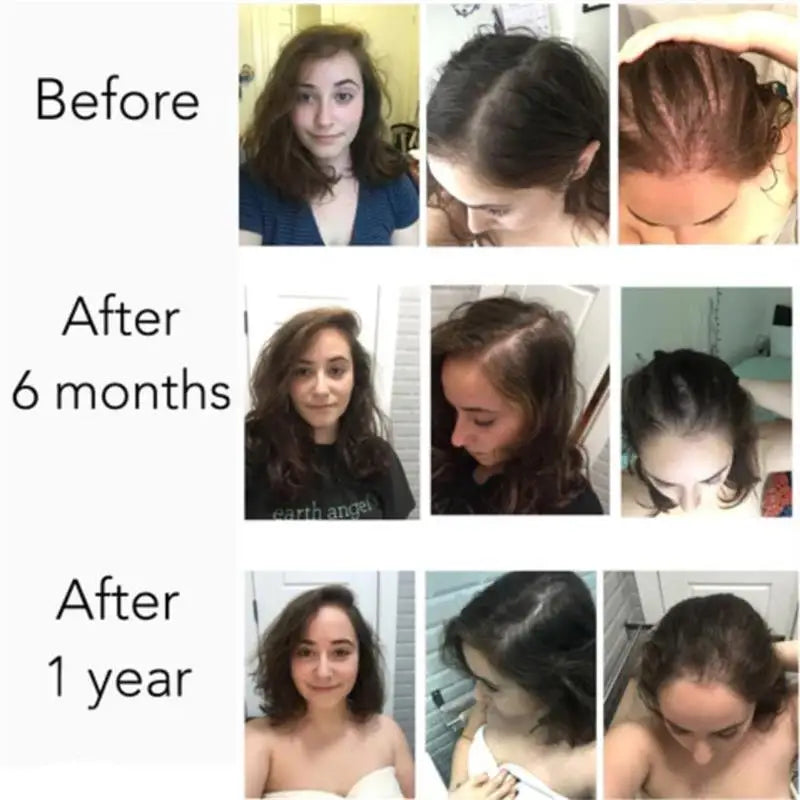Serenlu Hair Growth Oil