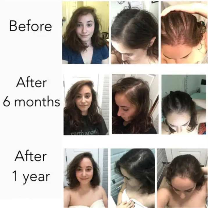 Serenlu Hair Growth Oil