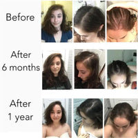 Serenlu Hair Growth Oil