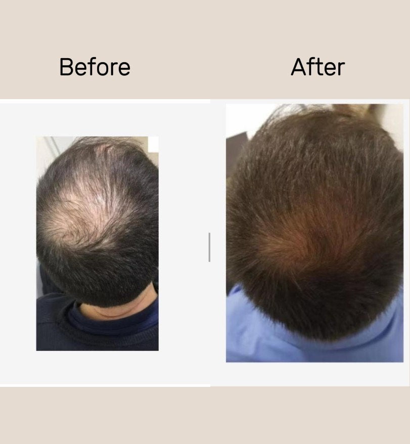 Serenlu Hair Growth Oil
