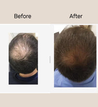 Serenlu Hair Growth Oil